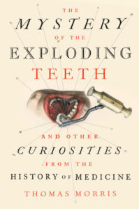 The Mystery of the Exploding Teeth