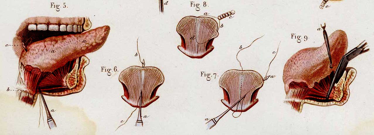 Tongue: How It's Eaten Around the World