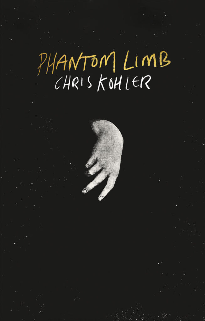 Chris Kohler phantom limb