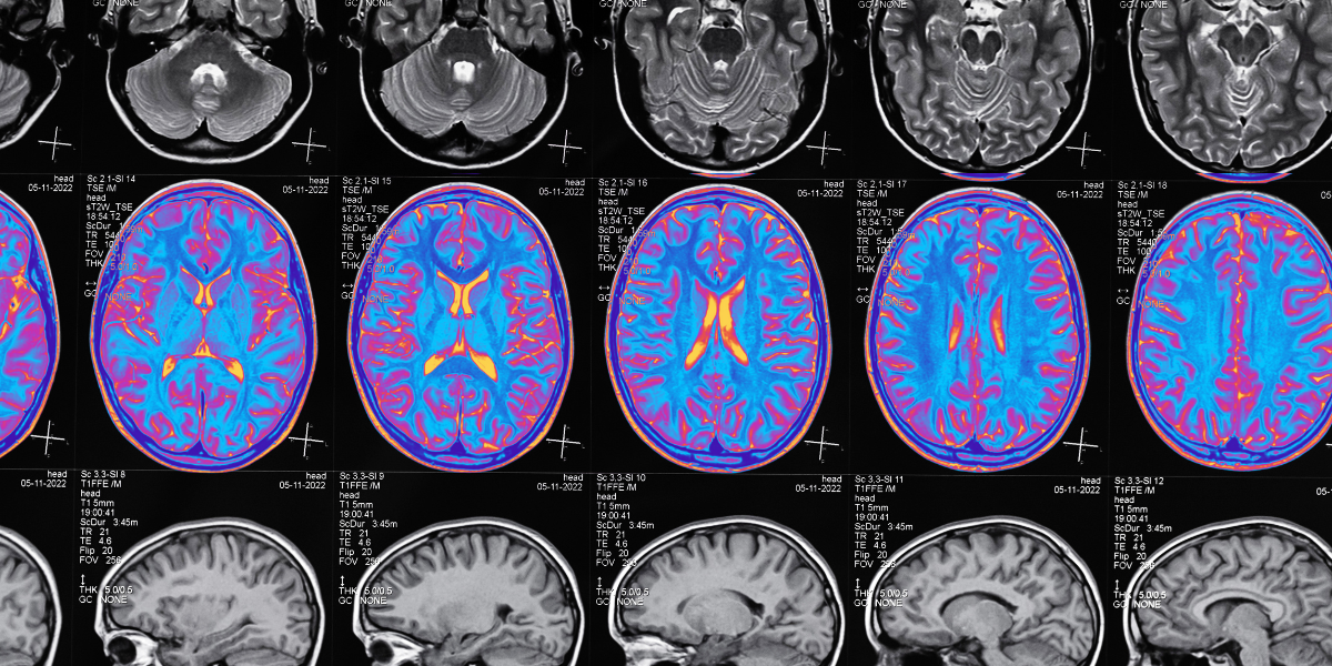 Beyond Memoir: A Roundtable on Health, Identity, and the Invisible Injury We Aren’t Talking About