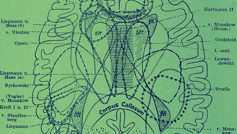 The Medicalization of Madness: How Schizophrenia Was Treated Throughout the Ages