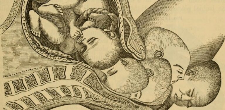 On Time, Pain and the Labor Process: Considering the History of Midwifery